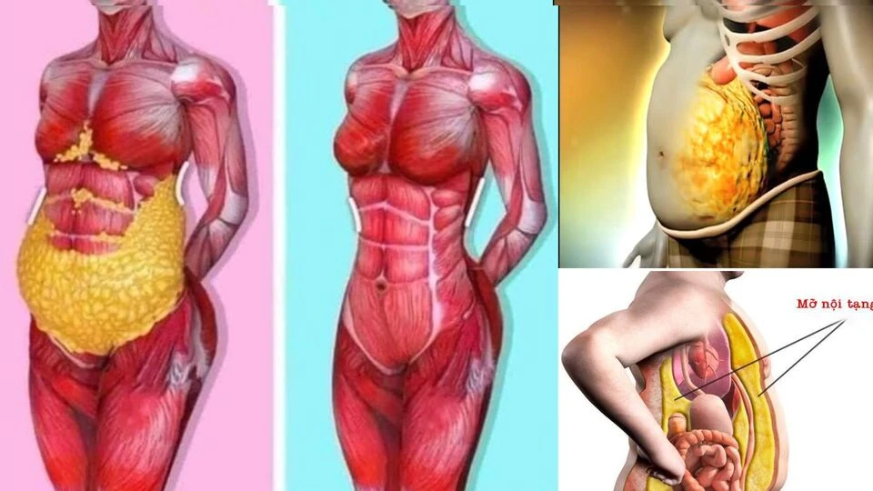Dư thừa mỡ nội tạng gây nên những bệnh gì? - Hình 1