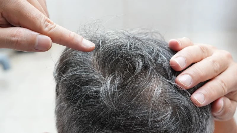 Trẻ ra vài tuổi nhờ loại quả rẻ tiền giúp nhuộm đen mái tóc bạc sớm - Hình 2