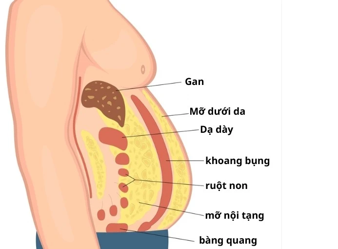 Mỡ nội tạng nguy hiểm hơn mỡ dưới da như thế nào? - Hình 1