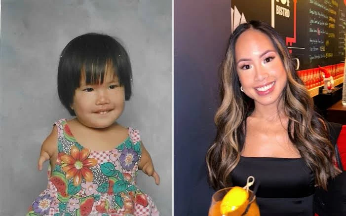 Cuộc sống khó tin của cô gái Việt không tay, được mẹ Mỹ nhận nuôi từ 7 tháng tuổi viral khắp MXH - Hình 1