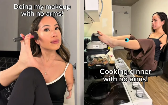 Cuộc sống khó tin của cô gái Việt không tay, được mẹ Mỹ nhận nuôi từ 7 tháng tuổi viral khắp MXH - Hình 6