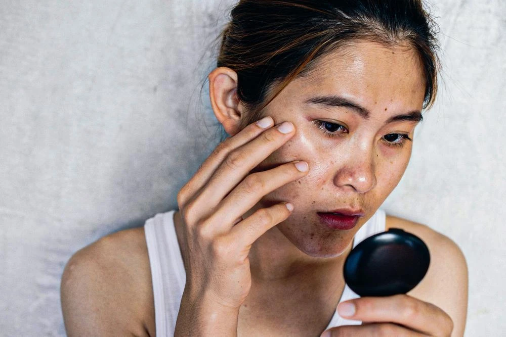 5 thói quen hằng ngày âm thầm khiến làn da dễ bị nám, nhiều người vẫn lặp lại mà không hay biết - Hình 2