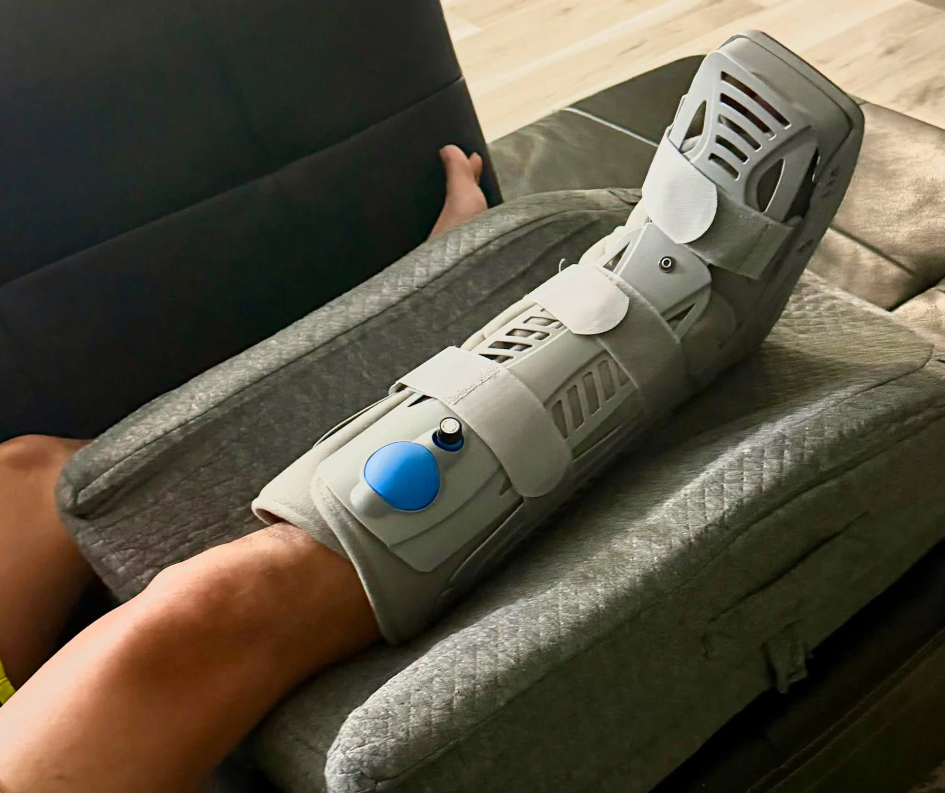 Ca sĩ Mạnh Quỳnh bị vỡ xương mắt cá chân - Hình 1
