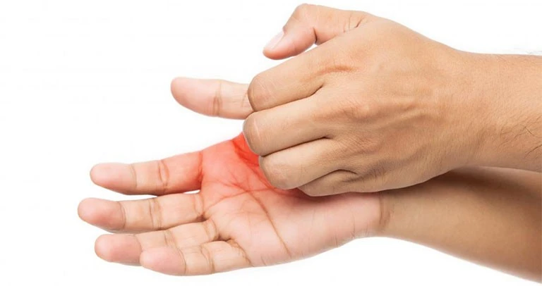 Ngứa lòng bàn tay, bàn chân kéo dài: Cẩn thận dấu hiệu liên quan đến bệnh gan - Hình 1