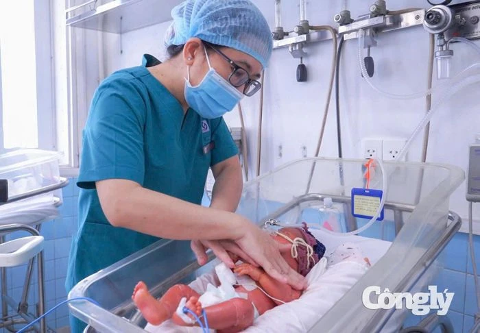 Bé trai sinh non mắc bệnh vảy cá hiếm gặp - Hình 1