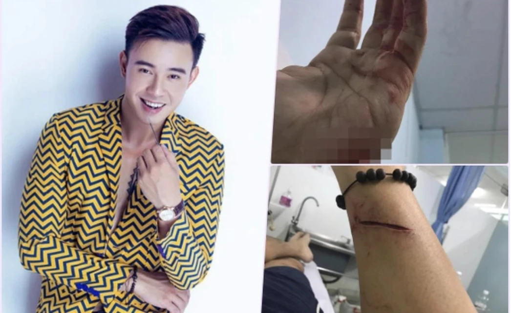 Ca sĩ Việt hát ca khúc 10 tỷ view vang danh Đại lễ: Gánh nợ 28 tỷ ở tuổi 20, đoạn tâm thư thấy rõ sự thật - Hình 4